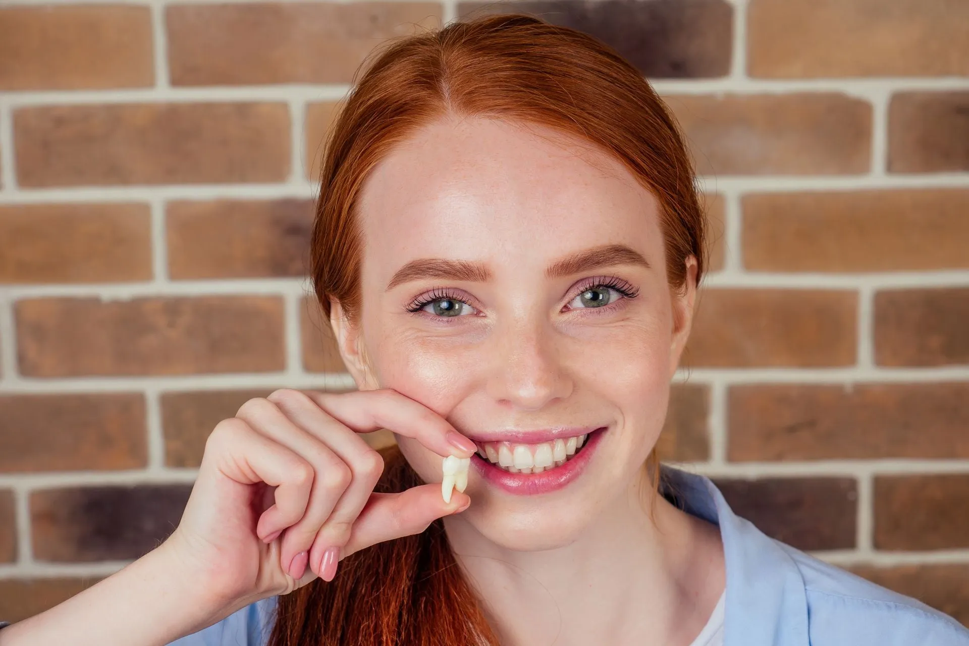 Wisdom Teeth Extraction
