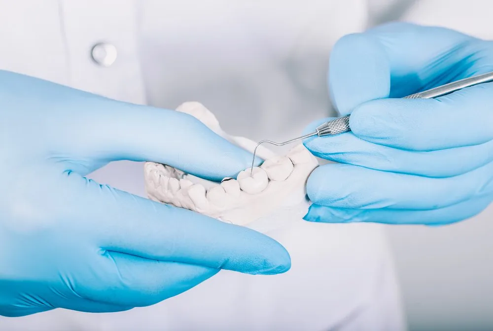 Dental Fillings — what to know
