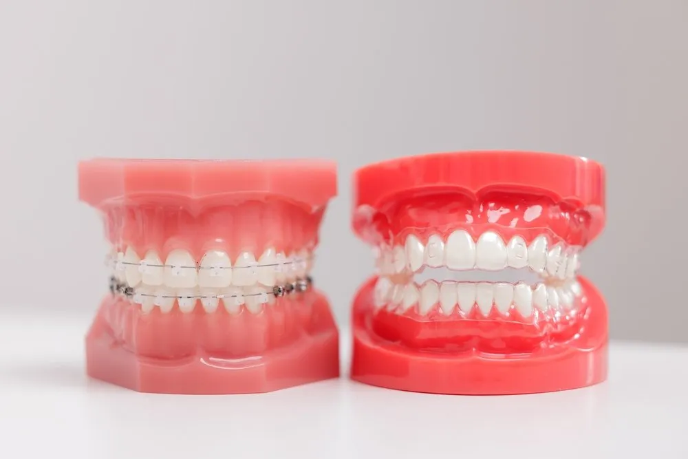 Retainers