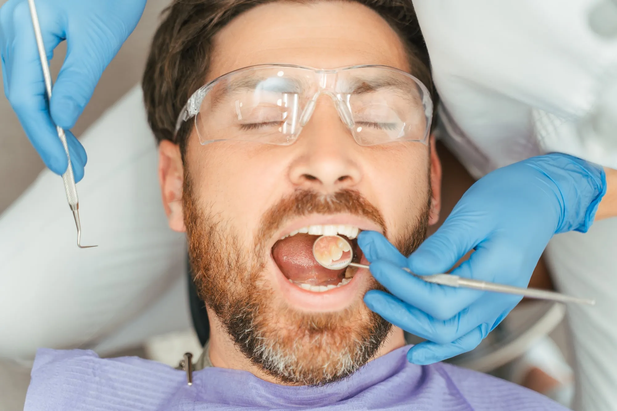 Dental Fillings