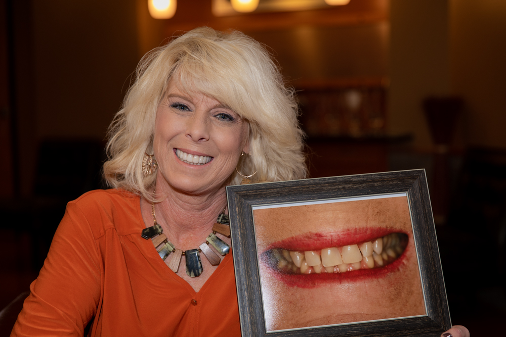 Best Same Day Dental Implants in Corsicana TX - Just Wright Dental