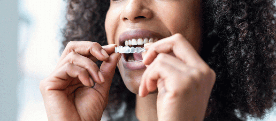 Woman wearing orthodontic silicone trainer. Invisible braces aligner.