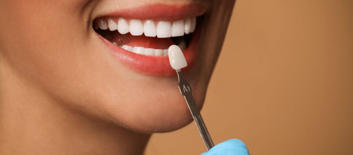 Doctor checking young woman's teeth color on beige background, closeup. Dental veneers