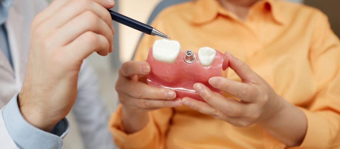 Closeup of unrecognizable dentist pointing at tooth model while explaining dental implant surgery to patient in clinic, discussing the dental implant treatment process