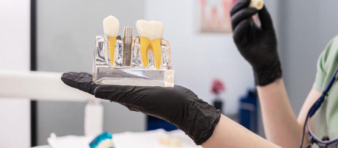 A dental professional in black gloves holds a clear model showing a dental implant with the post and crown.