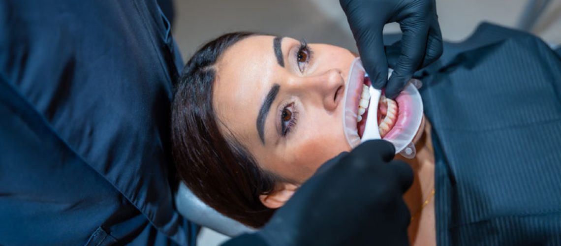 Dentist wearing black gloves applying teeth whitening gel to a female patient in a dental clinic.