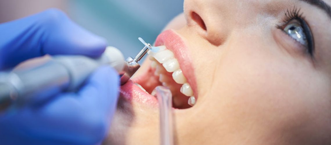 dental-patient-undergoing-teeth-cleaning.