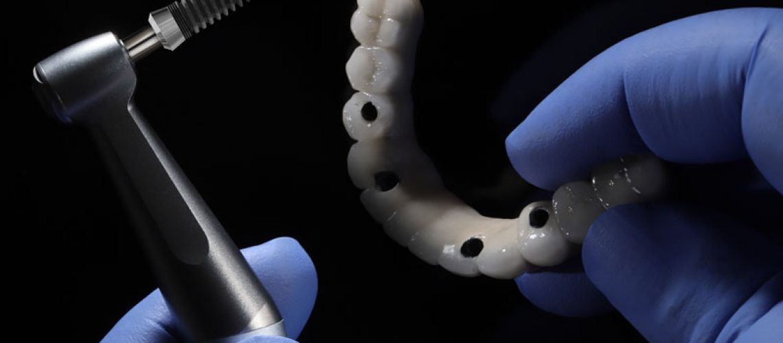 a full arch of teeth with 4 holes for dental implants to be placed