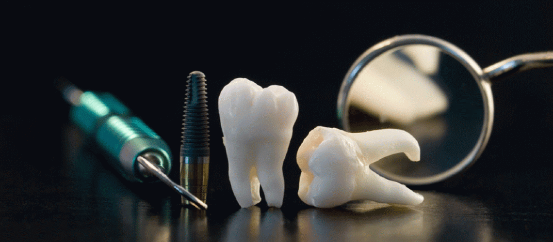 models of dental tools and implants and crowns on a reflective table.