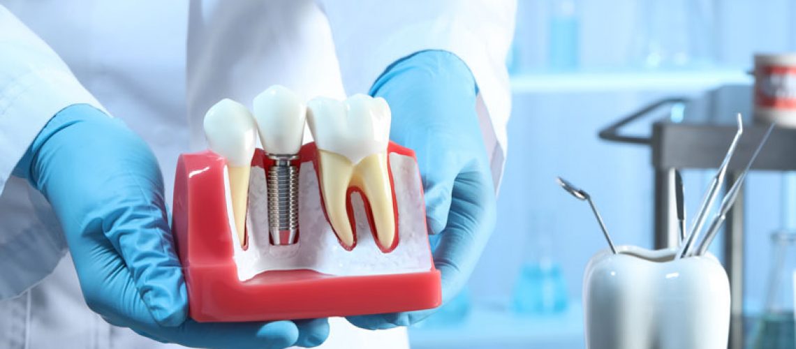 dentist holding up tooth model of dental implant cut away with a tooth shaped tool holder in the back