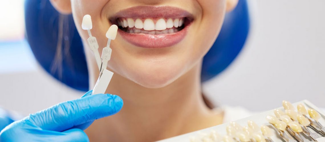 a dentist holding up a color matching tray to the patient to make her veneers