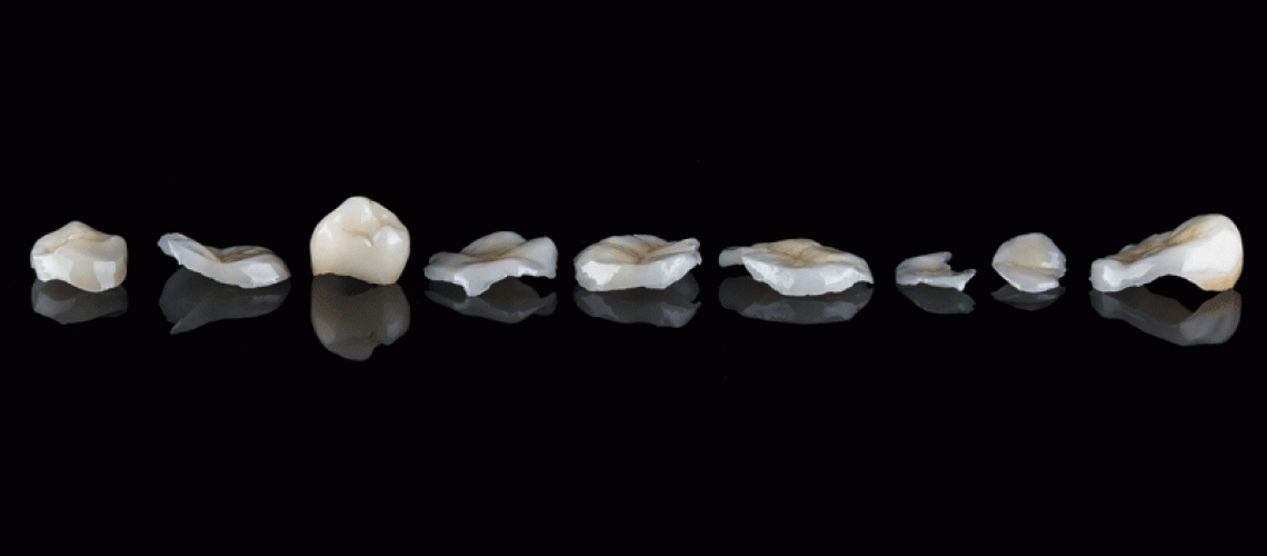 dental crowns and veneers laying on black reflective glass
