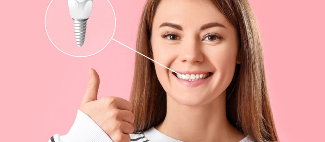 a woman smiling with implants in her teeth smiling widely
